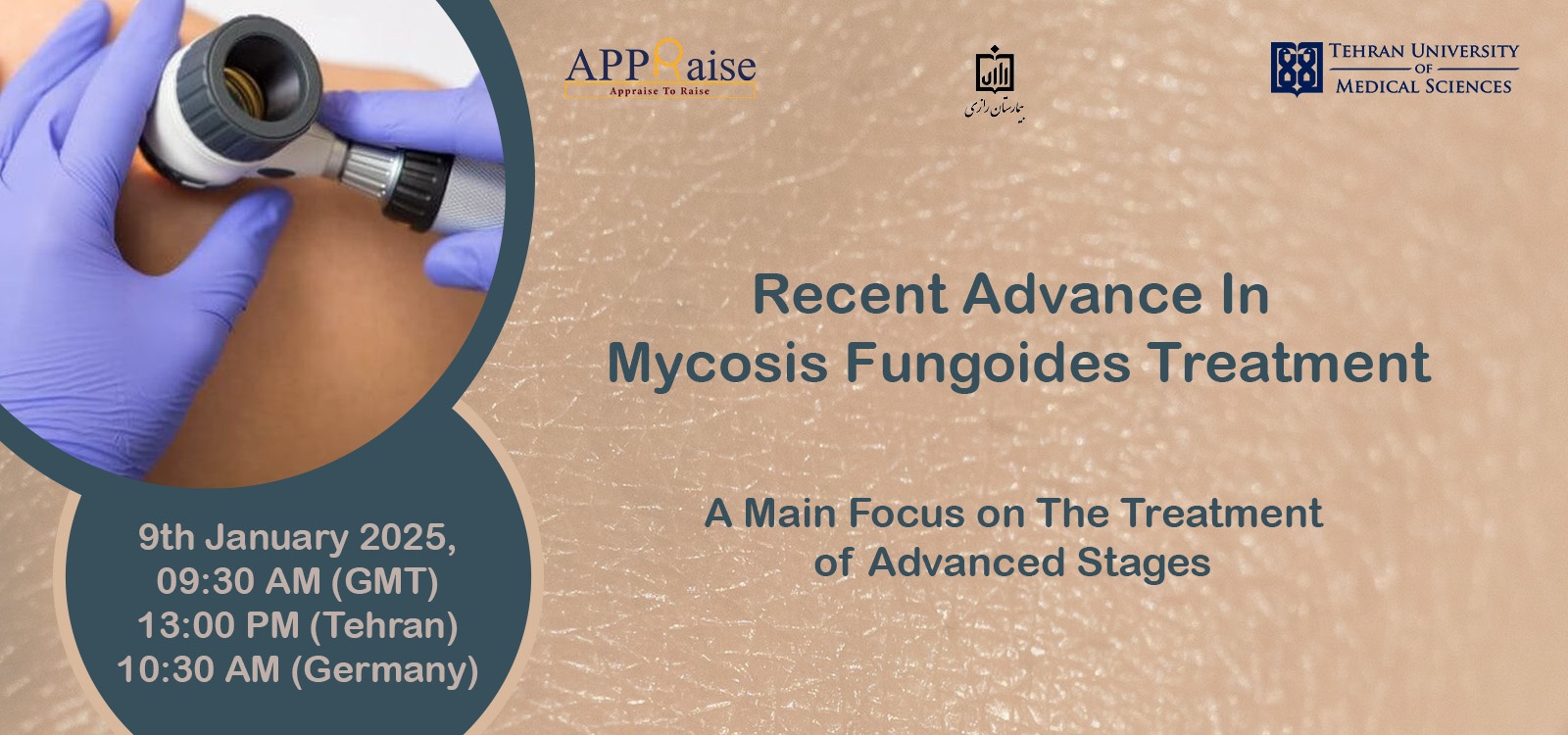 Recent Advance in Mycosis Fungoides Treatment