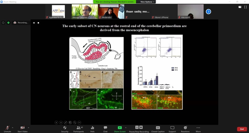 Webinar on “Cerebellar Development in Health and Diseases”