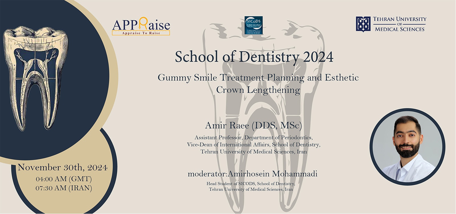 Gummy Smile Treatment Planning and Esthetic Crown Lengthening